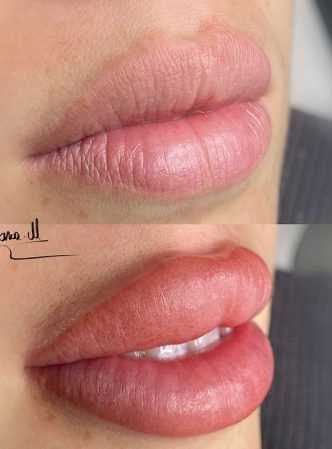 MICROPIGMENTACION labios - DIANA M - villalba