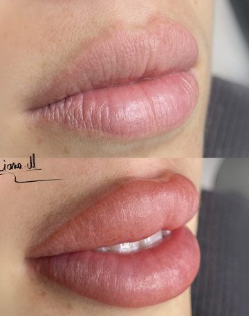 MICROPIGMENTACION labios - DIANA M - villalba