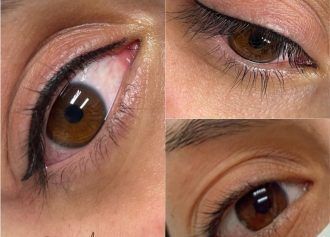 micropigmentación